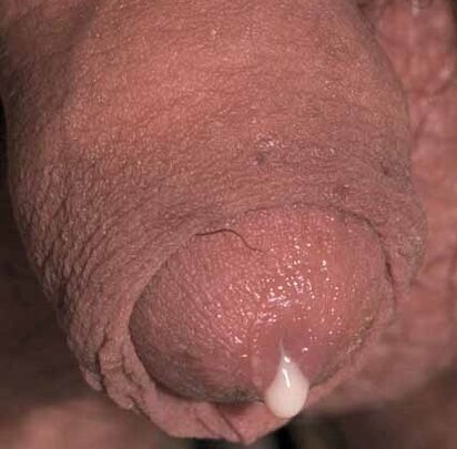 abnormal secretion when stimulated